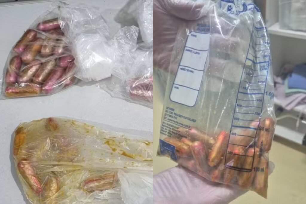 boliviano-e-preso-com-drogas-no-intestino-apos-reclamar-de-mal-estar