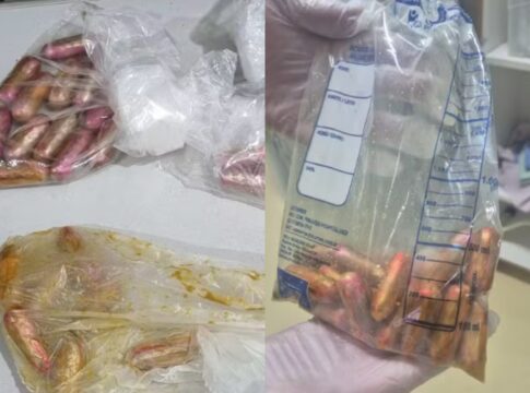 boliviano-e-preso-com-drogas-no-intestino-apos-reclamar-de-mal-estar