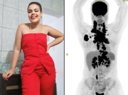 jovem-conta-sinais-que-ignorou-de-cancer-que-a-“esmagava-por-dentro”