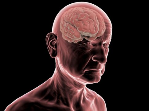 estudo:-demencia-pode-levar-mais-de-tres-anos-para-ser-diagnosticada