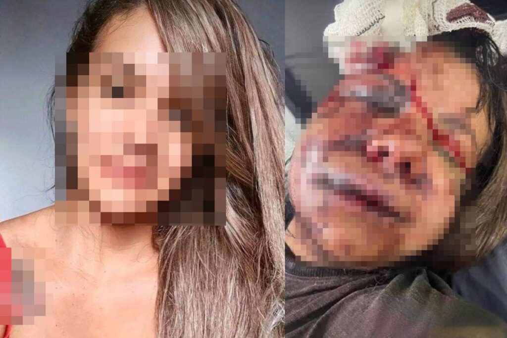 mulher-espancada-por-ex-jogador-de-basquete-teve-rosto-desfigurado