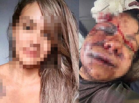 mulher-espancada-por-ex-jogador-de-basquete-teve-rosto-desfigurado