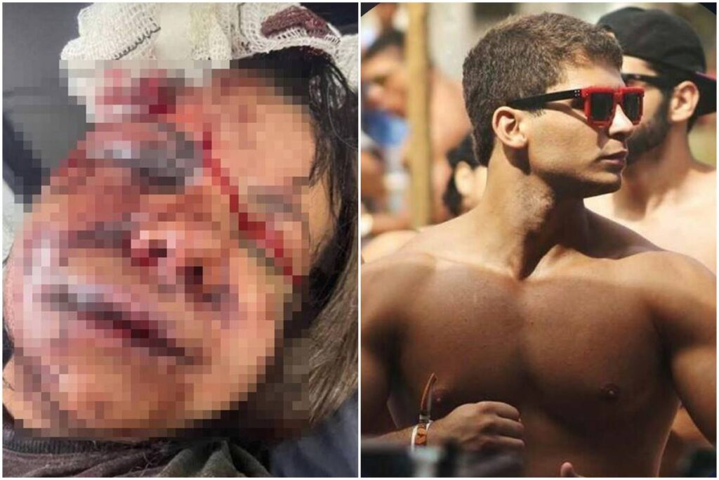 “focar-na-recuperacao”,-diz-mulher-que-levou-60-socos-de-ex-atleta