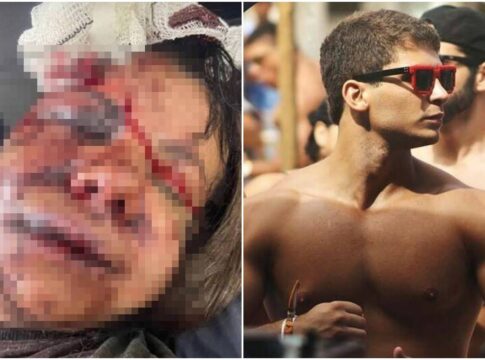 “focar-na-recuperacao”,-diz-mulher-que-levou-60-socos-de-ex-atleta