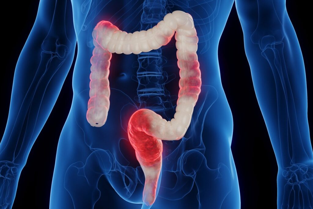 veja-3-alimentos-anti-inflamatorios-que-auxiliam-na-limpeza-do-colon