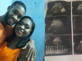 mulher-descobre-gravidez-com-9-meses-de-gestacao:-“fiquei-fora-de-mim”