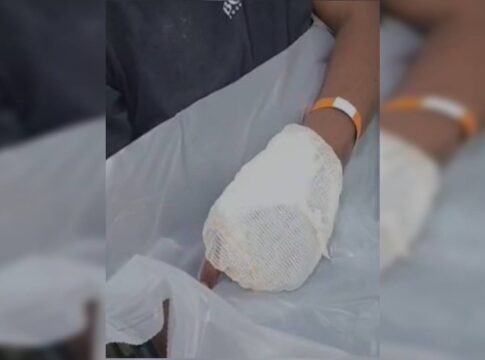 vitima-coloca-mao-na-frente-de-arma-e-tem-dedos-“explodidos”-por-tiro