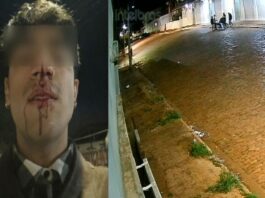 camera-mostra-artista-sendo-espancado-apos-beijar-rapaz-em-ms.-video