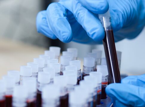 ciencia-descobre-como-reverter-envelhecimento-da-pele-com-sangue-jovem