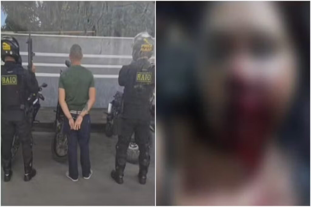 homem-e-preso-apos-desfigurar-rosto-de-companheira-enquanto-dormia