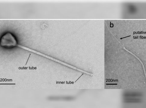 cientistas-encontram-virus-com-a-cauda-mais-longa-ja-observada