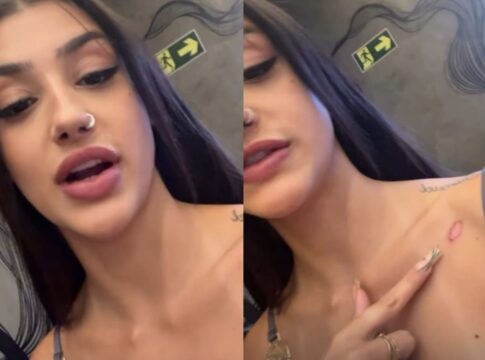 bia-miranda-mostra-ferimento-apos-acidente