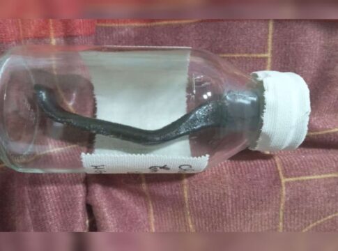 ciclista-atropelado-fica-9-meses-com-peca-de-bicicleta-na-barriga
