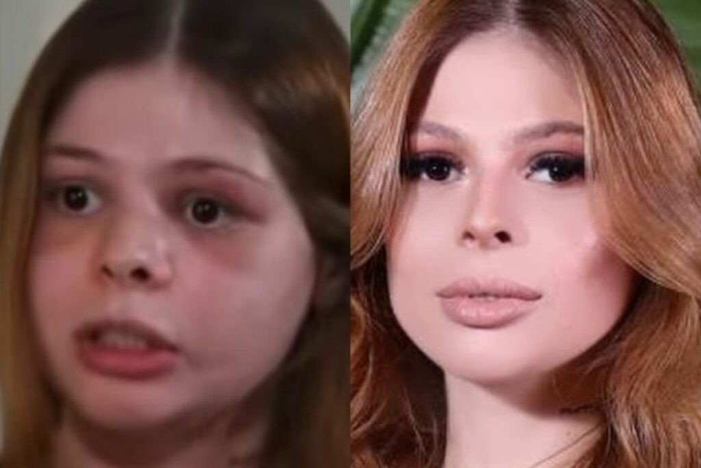 caso-samira:-especialistas-pedem-punicao-exemplar-apos-agressao-brutal