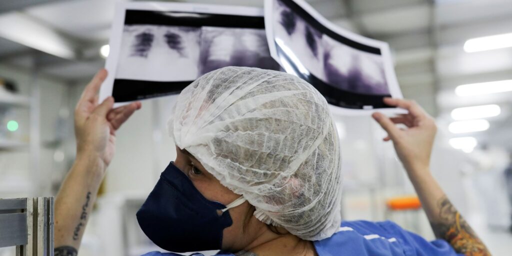 cancer-de-pulmao:-15%-dos-casos-acontecem-em-nao-fumantes