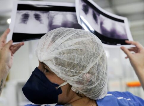 cancer-de-pulmao:-15%-dos-casos-acontecem-em-nao-fumantes