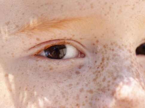 reflexo-branco-nos-olhos:-entenda-condicao-que-assusta-pais