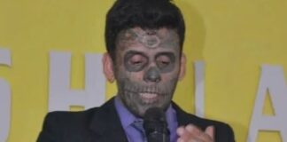 homem-“mais-tatuado-do-brasil”-remove-tatuagens-do-rosto;-veja