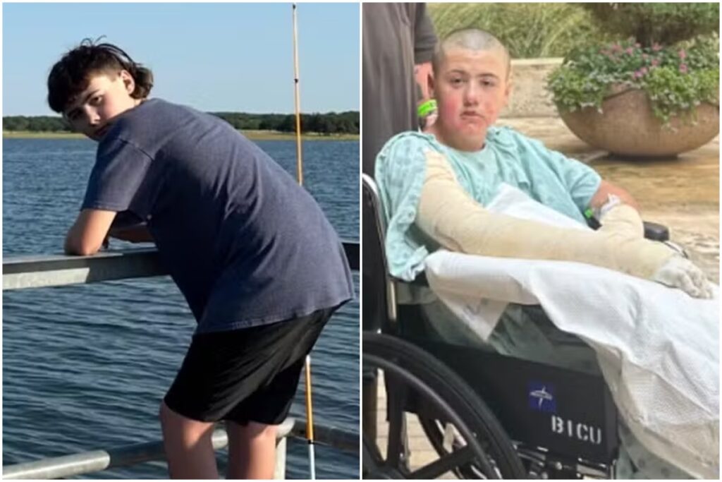 menino-tem-11%-do-corpo-queimado-apos-video-viral-no-tiktok-dar-errado