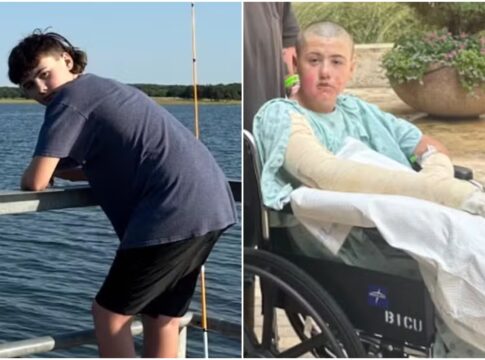 menino-tem-11%-do-corpo-queimado-apos-video-viral-no-tiktok-dar-errado