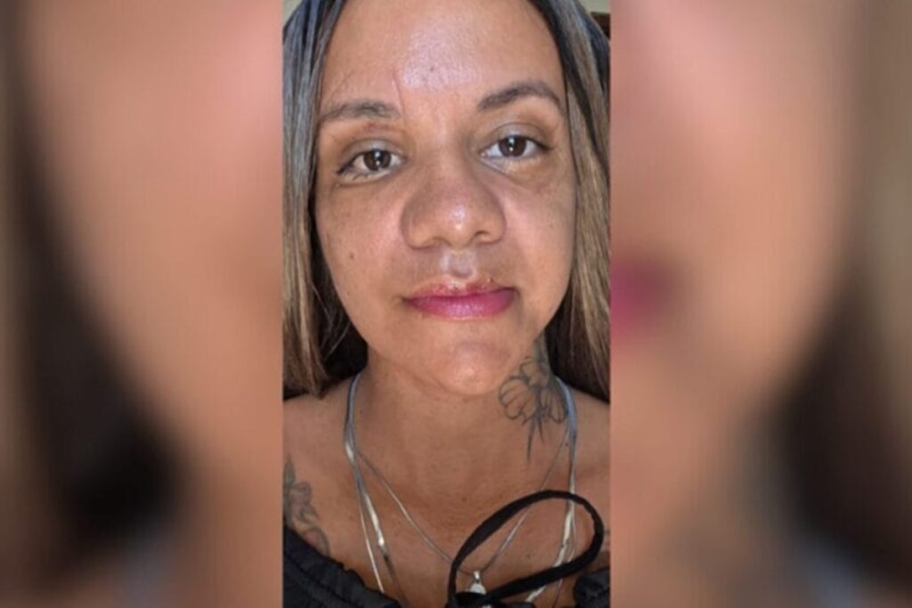 mulher-agredida-com-61-socos-mostra-resultado-de-reconstrucao-facial