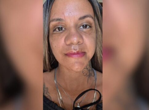 mulher-agredida-com-61-socos-mostra-resultado-de-reconstrucao-facial
