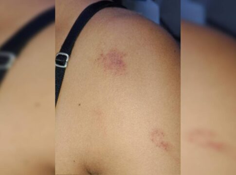 marido-e-preso-apos-agredir-e-deixar-mulher-com-marcas-roxas-no-corpo