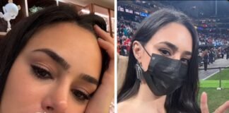 bruna-biancardi-assusta-ao-mostrar-inchaco-no-rosto-e-explica-motivo