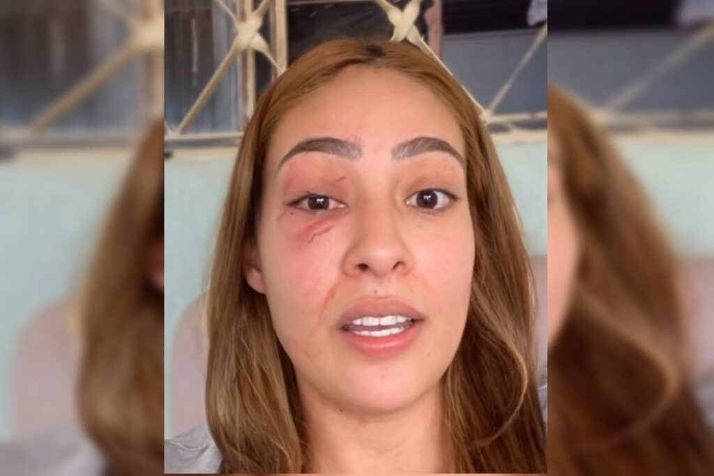 mulher-e-ameacada-apos-denunciar-vizinho:-“sua-vagabunda,-safada”