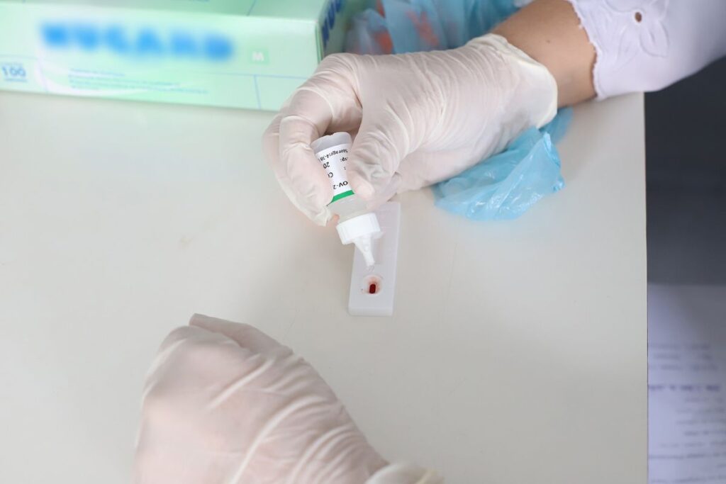 paciente-de-sp-fica-15-meses-curado-do-hiv-com-tratamento-experimental