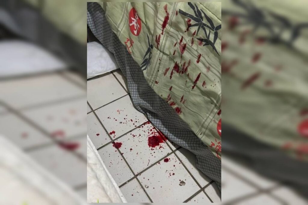 filho-espancado-pelo-pai-suja-quarto-de-sangue-na-asa-norte