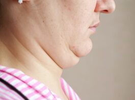 como-reduzir-a-papada?-experts-dao-dicas-de-treino-e-alimentacao
