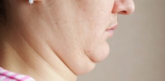como-reduzir-a-papada?-experts-dao-dicas-de-treino-e-alimentacao