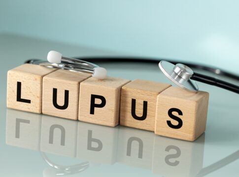 ans-inclui-remedios-contra-lupus-no-rol-de-coberturas-obrigatorias