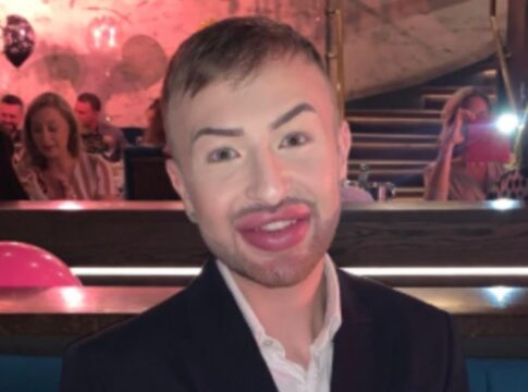 jovem-gasta-mais-de-r$-25-mil-com-preenchimentos-e-se-arrepende