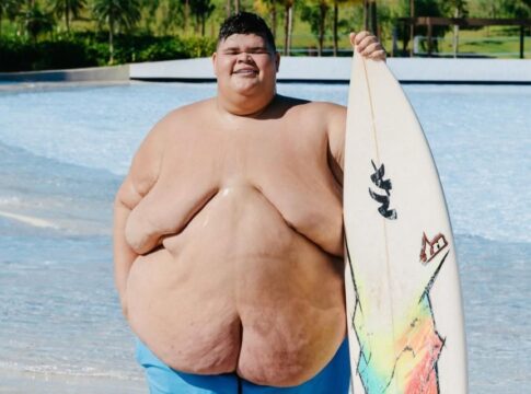 gordao-da-xj-bate-meta-e-perde-115-kg:-veja-antes-e-depois