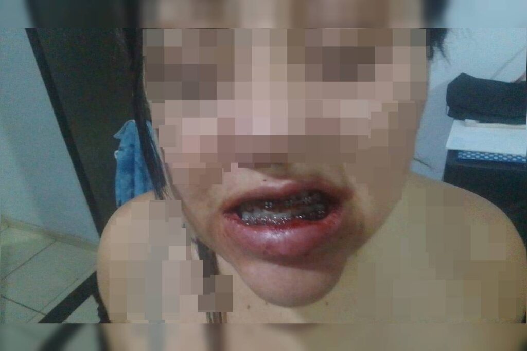 veja-como-ficou-mulher-agredida-pelo-companheiro-em-escada-de-predio