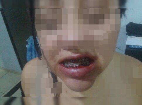 veja-como-ficou-mulher-agredida-pelo-companheiro-em-escada-de-predio