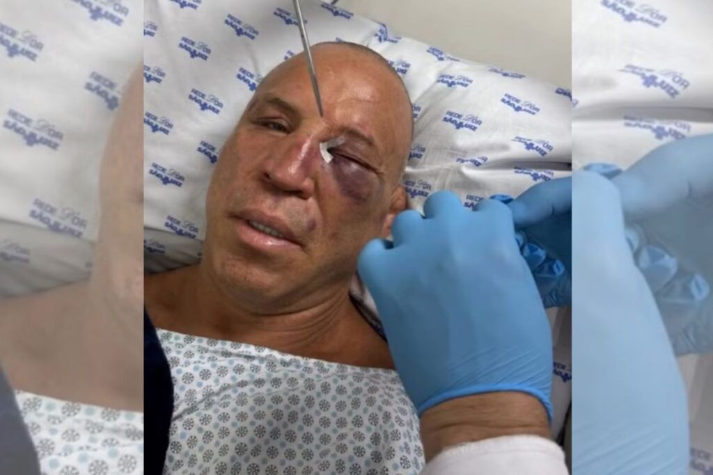 wanderlei-silva-foi-ao-hospital-apos-nocaute-em-confusao-generalizada