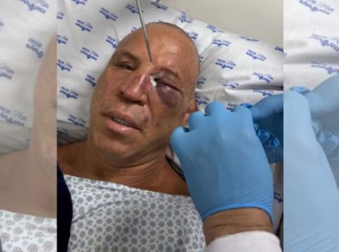 wanderlei-silva-foi-ao-hospital-apos-nocaute-em-confusao-generalizada