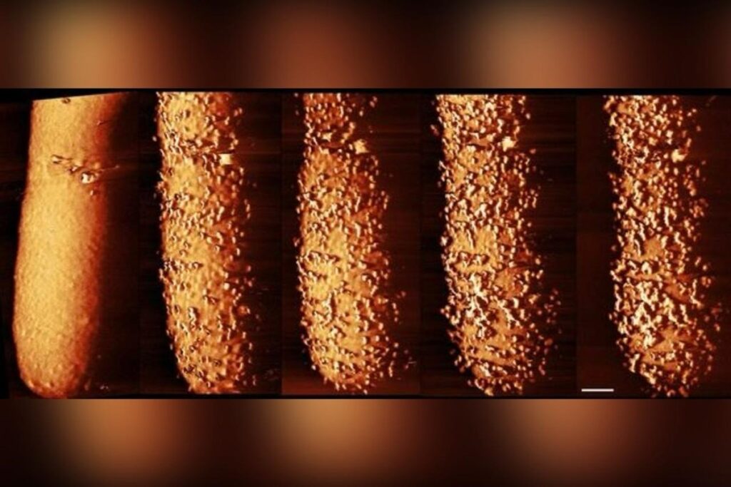 imagens-revelam-como-antibiotico-rompe-defesa-de-bacterias-resistentes