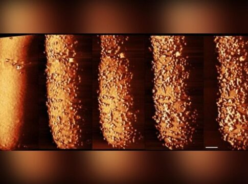 imagens-revelam-como-antibiotico-rompe-defesa-de-bacterias-resistentes