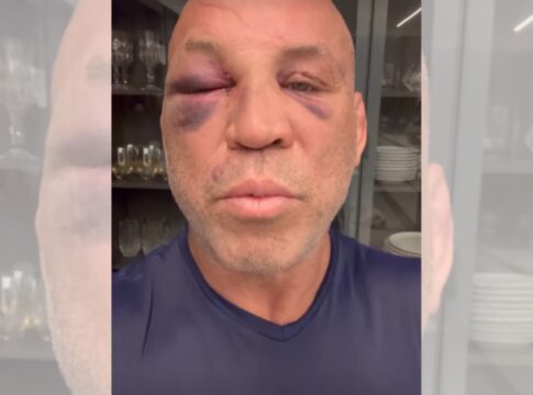 wanderlei-silva-detalha-recuperacao:-“memoria-esta-voltando”.-video