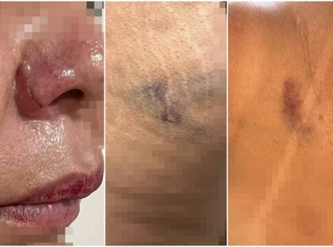 “se-nao-ficar-comigo,-eu-te-mato”:-homem-e-preso-apos-agredir-mulher