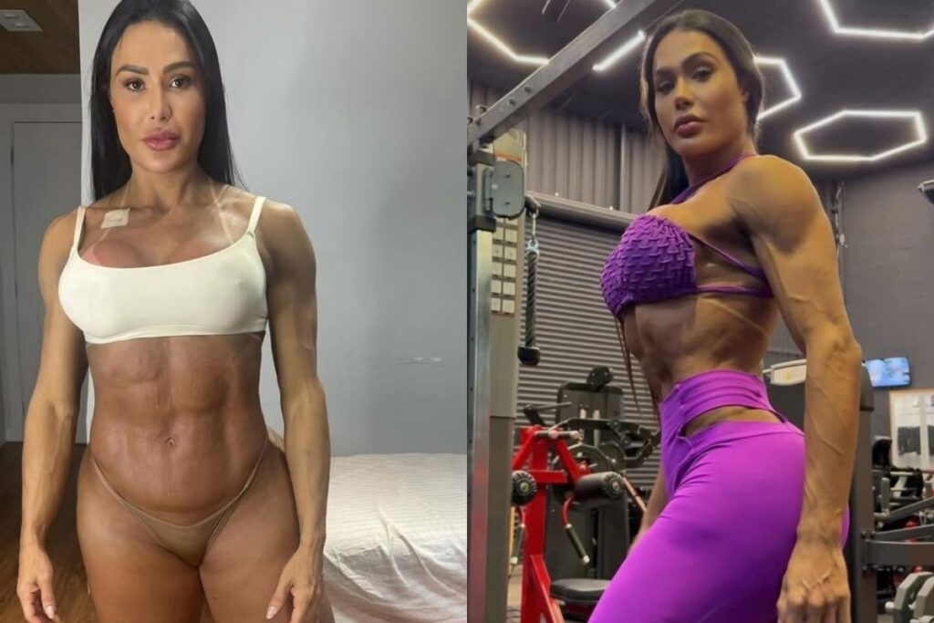 Gracyanne explica ganho de 20 kg após cirurgia: “Tomei um susto” gracyanne-explica-ganho-de-20-kg-apos-cirurgia:-“tomei-um-susto”