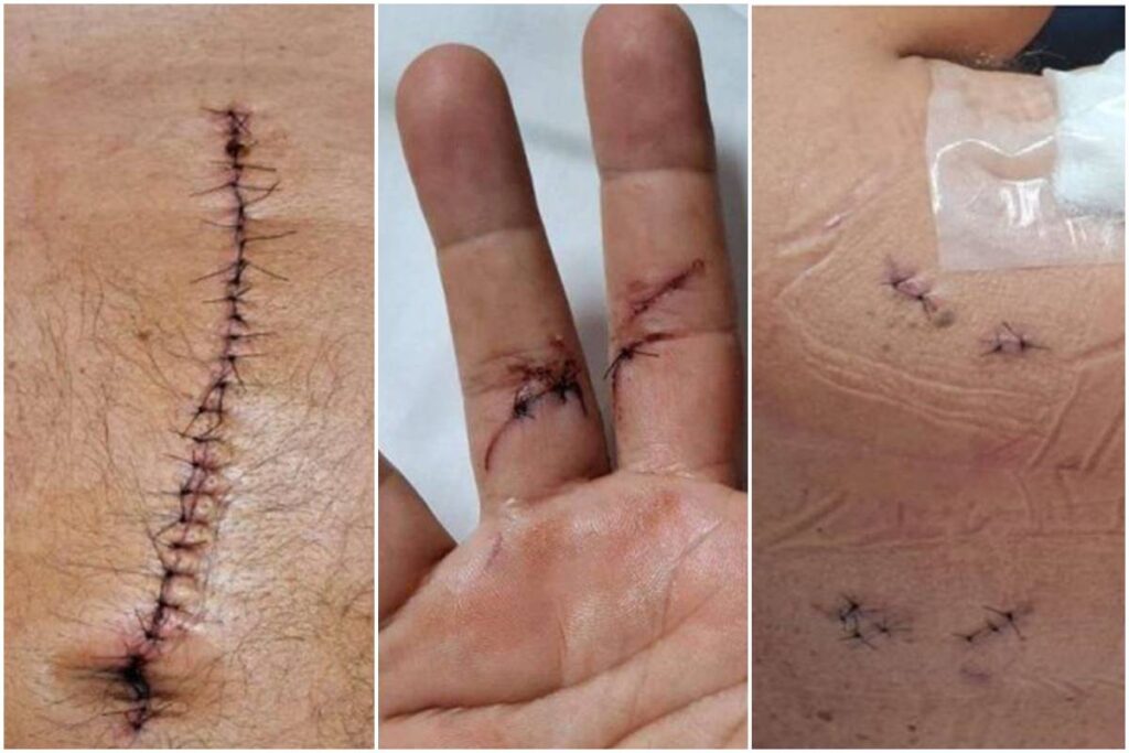 veja-lesoes-de-major-esfaqueado-em-transito-por-sargento-que-foi-solto