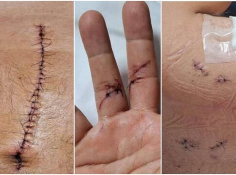 veja-lesoes-de-major-esfaqueado-em-transito-por-sargento-que-foi-solto