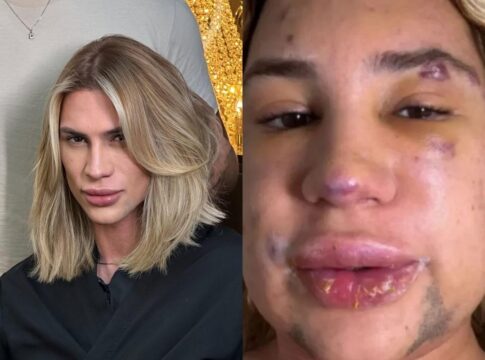 influencer-que-morreu-apos-procedimento-havia-denunciado-medico