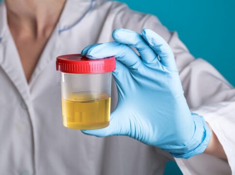 proteina-presente-na-urina-pode-sinalizar-risco-de-demencia.-entenda
