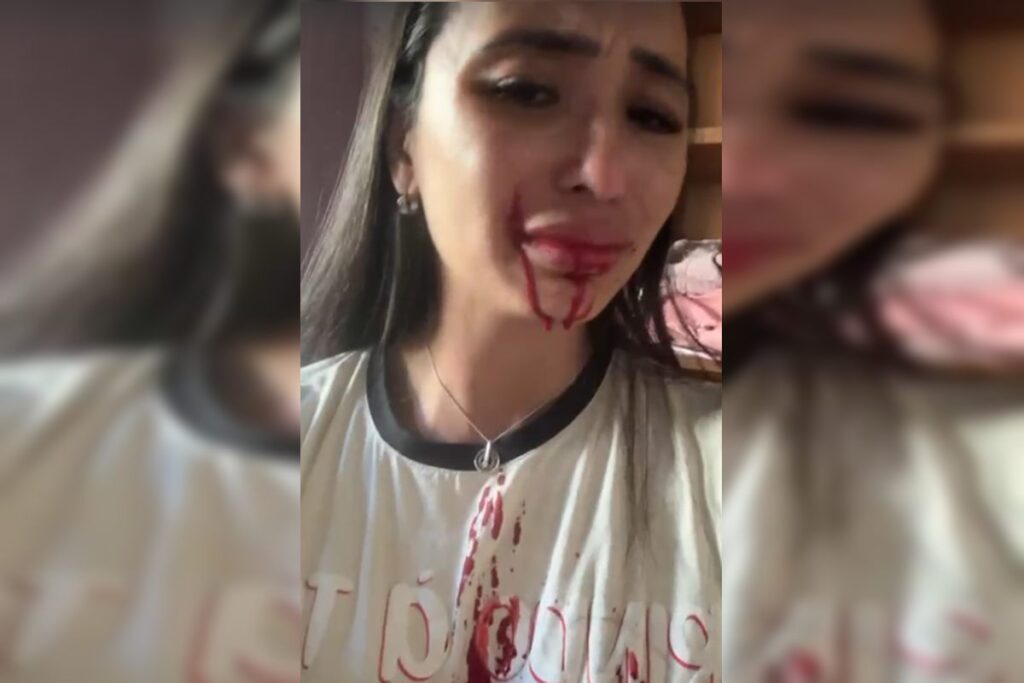 video:-em-surto,-mae-joga-facao-no-rosto-de-ex-dancarina-do-faustao